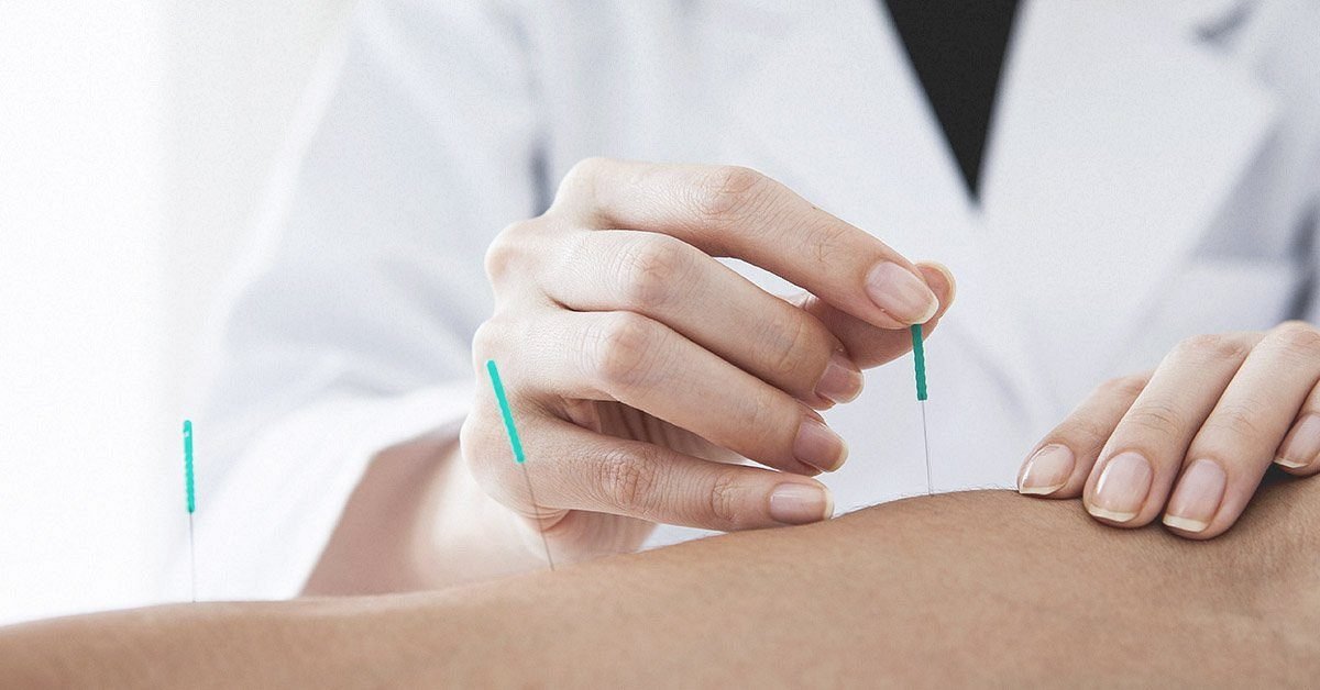 Dry Needling Treatment In Karachi