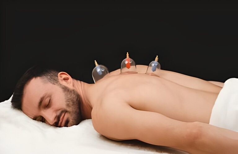 Dry cupping and dynamic cupping in Islamabad and Rawalpindi