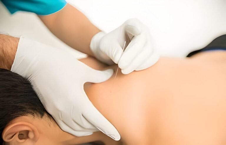Dry needling in Islamabad and Rawalpindi